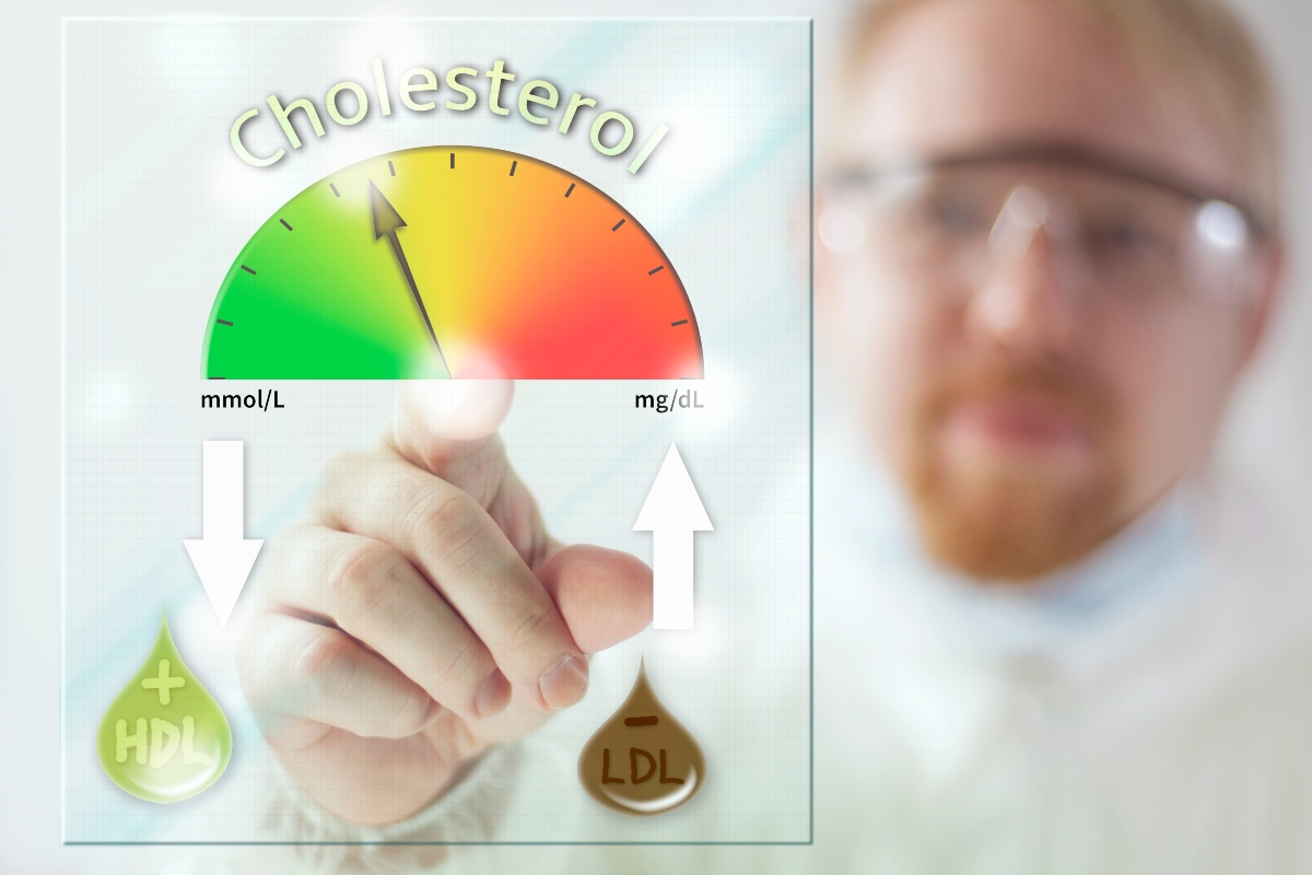 Colesterolo HDL (buono): che cos'è, valori normali e cosa fare quando è alto o basso 7 colesterolo HDL: diagnosi e cure
