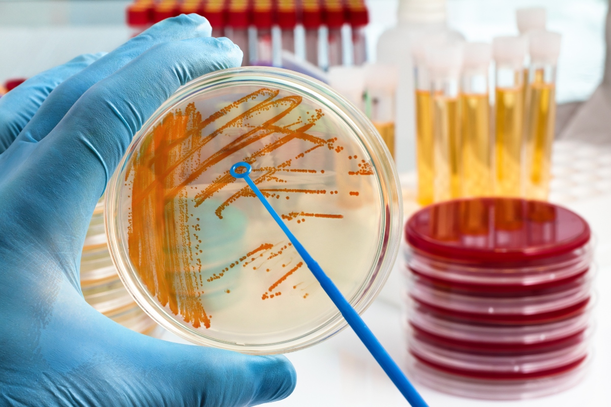 Cistite maschile: che cos'è, cause e sintomi, diagnosi e cure 5 cistite maschile: cure