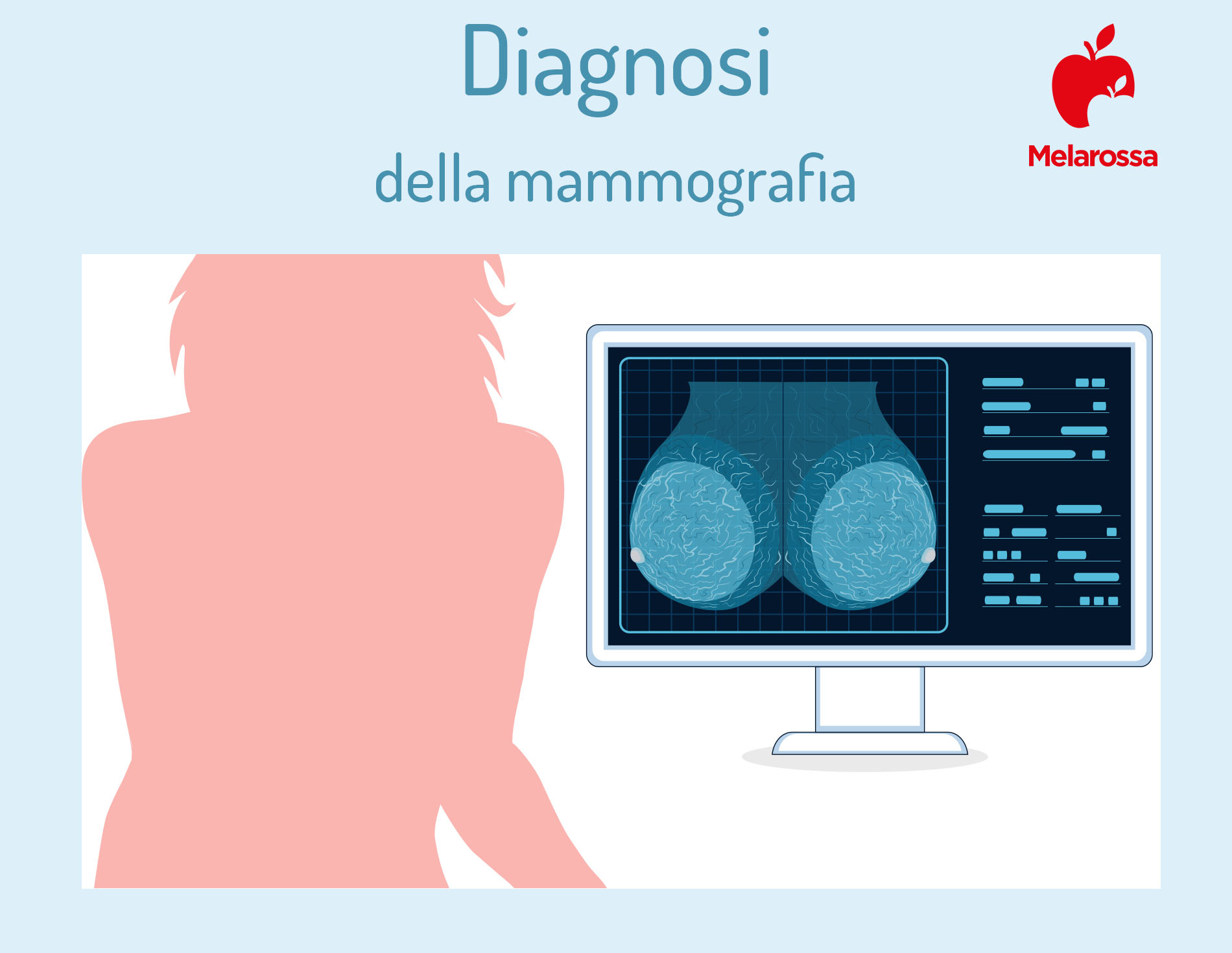 Mammografia: cos'è, come si esegue, quando farla, a cosa serve, differenze con l'ecografia mammaria 5 mammografia: diagnosi