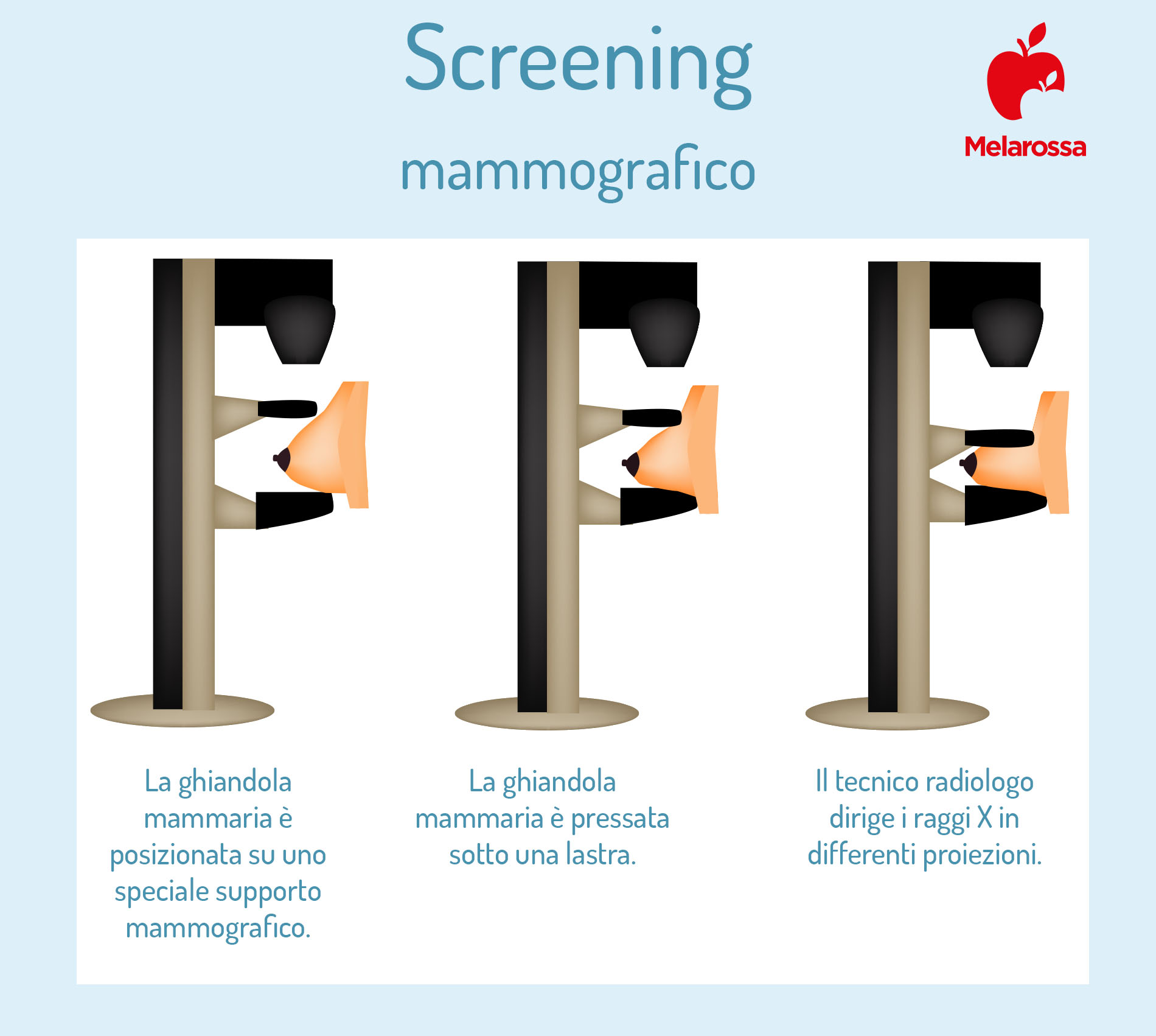 Mammografia: cos'è, come si esegue, quando farla, a cosa serve, differenze con l'ecografia mammaria 4 mammografia: come si esegue l'esame