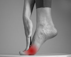 Neuroma di Morton o metatarsalgia: che cos&rsquo;&egrave;, sintomi e cause, come si cura