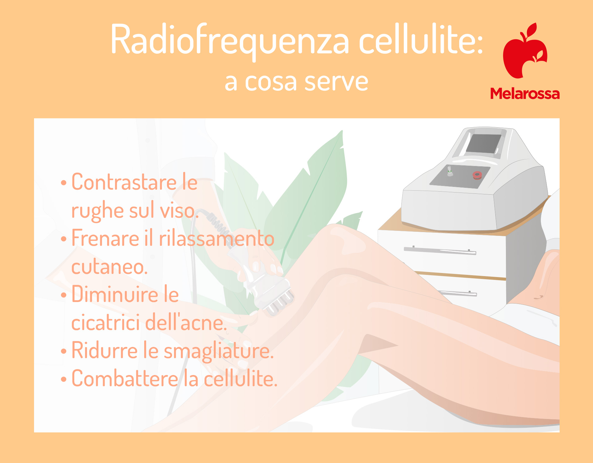 Radiofrequenza cellulite: cos'è, risultati, costi e controindicazioni 3 Radiofrequenza anticellulite: a cosa serve