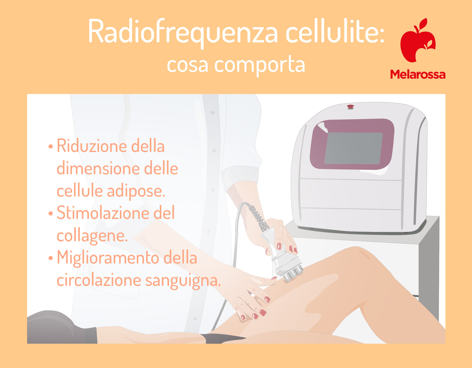 Radiofrequenza cellulite: cos'è, risultati, costi e controindicazioni 1 Radiofrequenza cellulite: cosa comporta