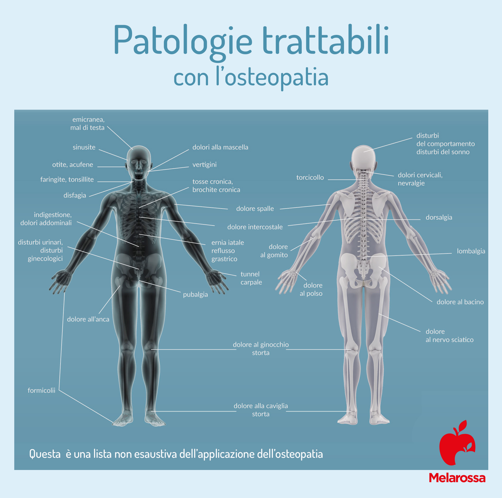 Osteopatia: che cos'è, cosa cura, principi, benefici, controindicazioni 3 osteopatia: patologie trattabili