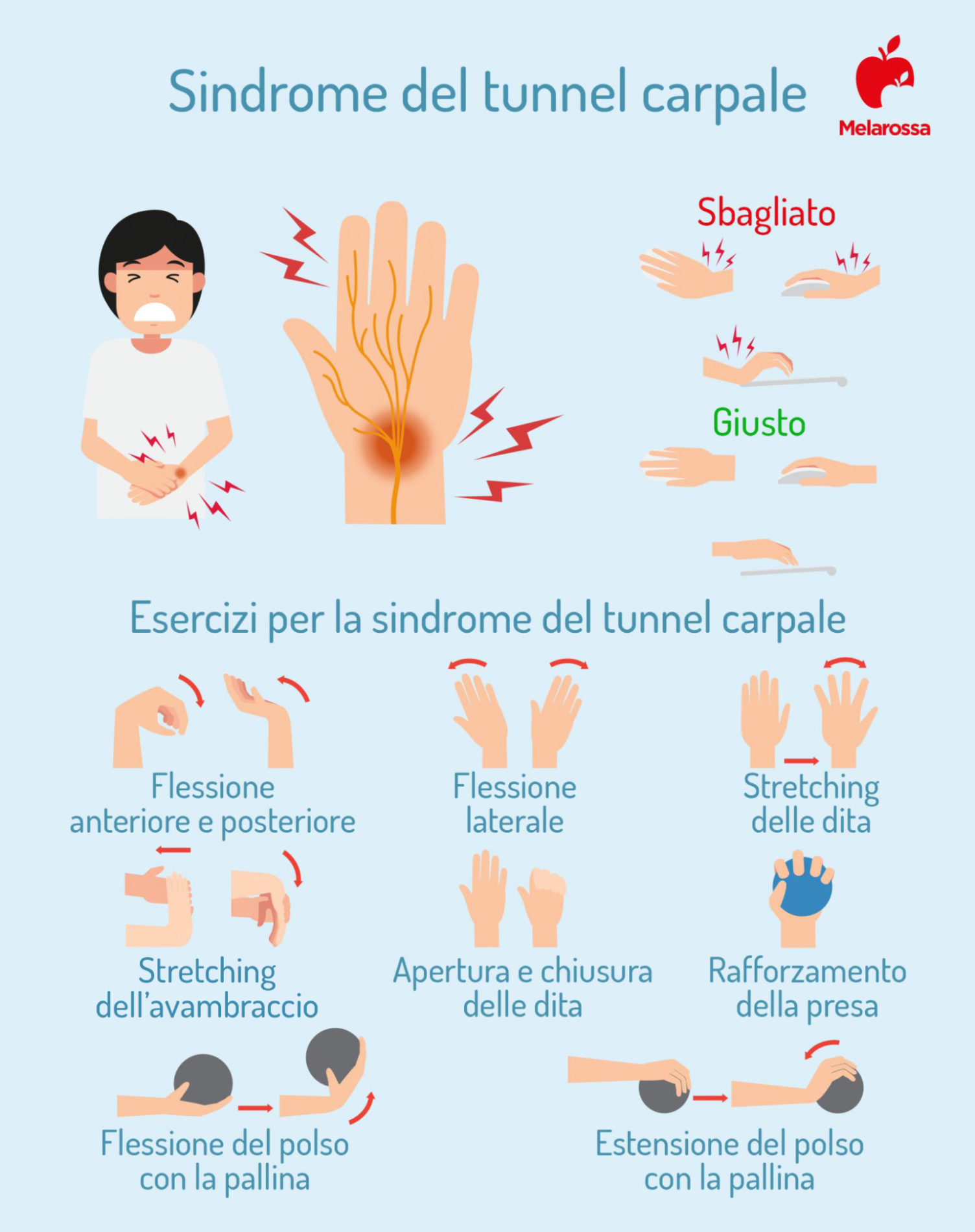 Sindrome del tunnel carpale: sintomi, rimedi ed esercizi per ridurre il dolore 3 sindrome del tunnel carpale esercizi