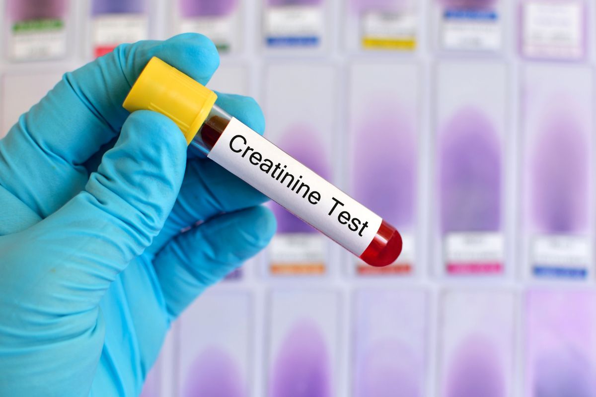Creatinina alta: cosa mangiare e dieta per abbassarla 2 test creatinina
