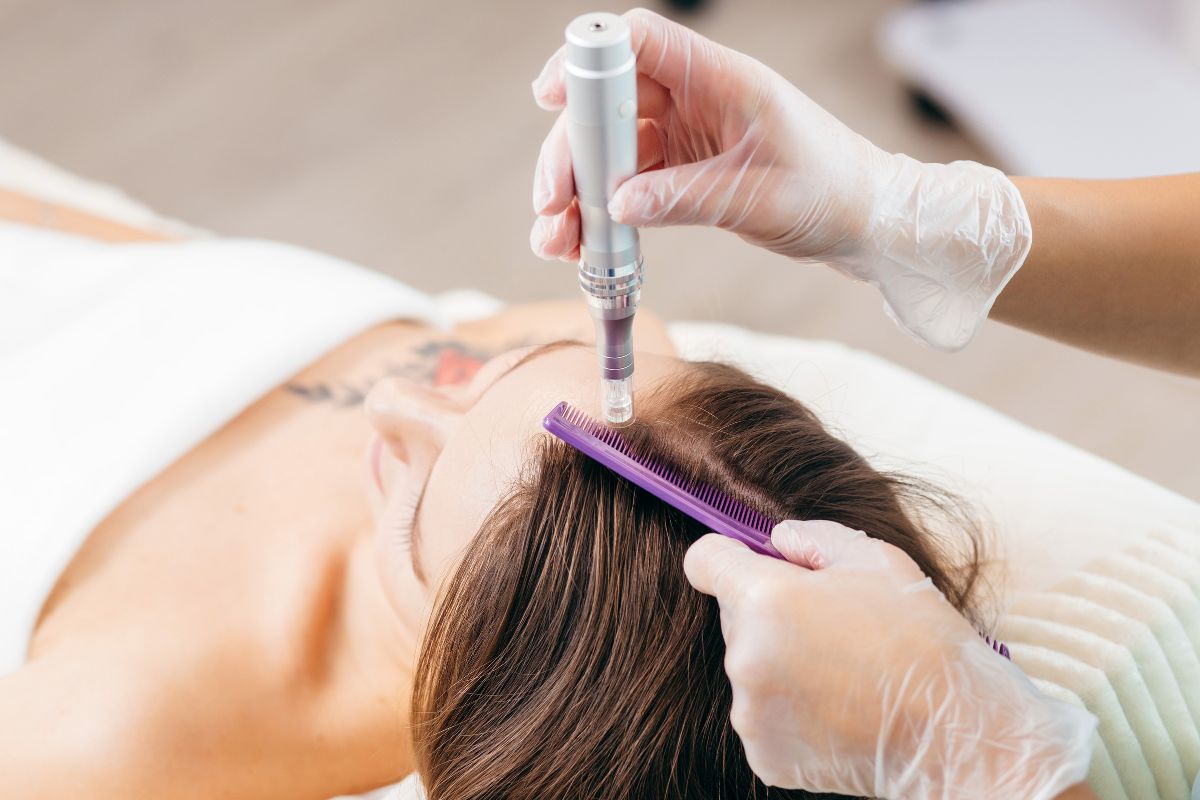 Alopecia femminile o androgenetica: cos’è, cause, come si presenta e cura 3 alopecia femminile: trattamenti