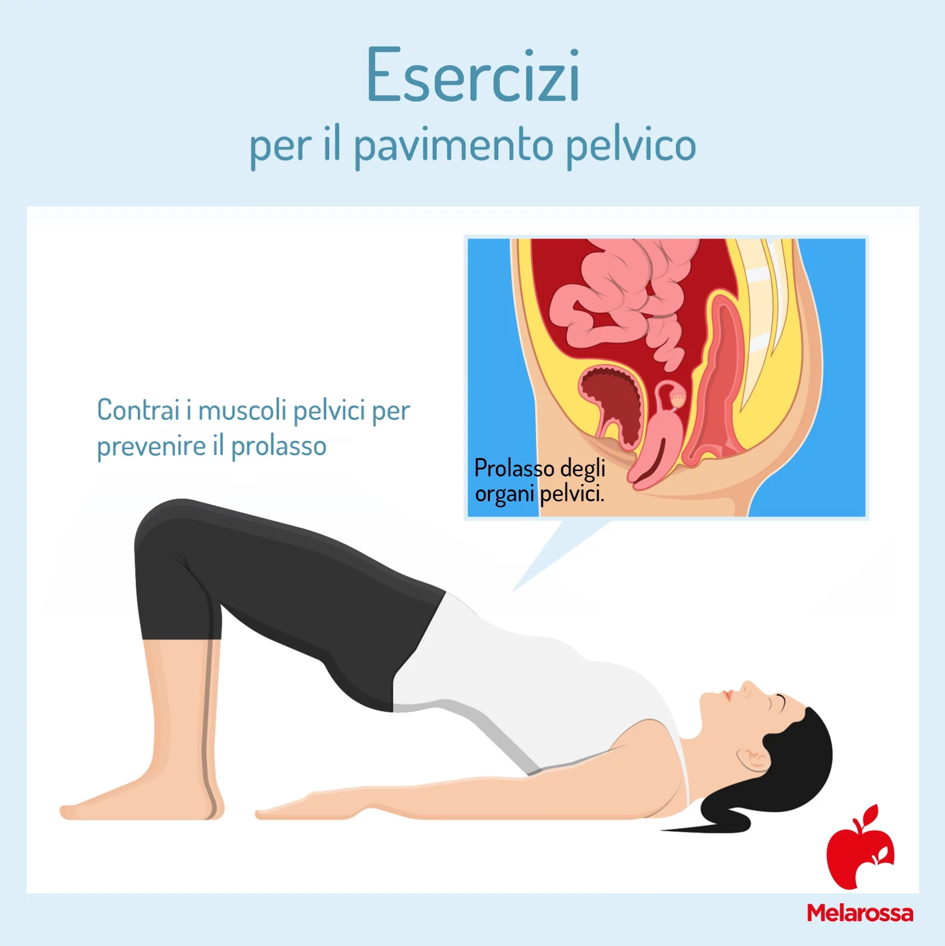 Pavimento pelvico: cos'è, perché è importante e come allenarlo 2 Una grafica sugli esercizi per il pavimento pelvico